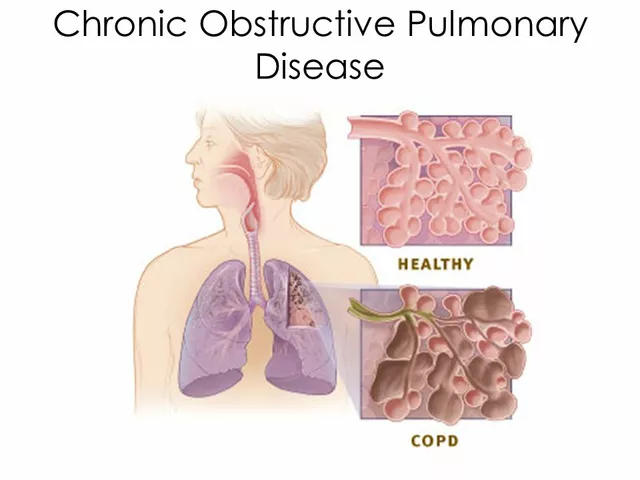 How to Support a Loved One with Chronic Obstructive Pulmonary Disorder