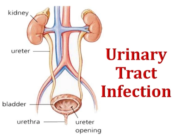 The Connection Between Diabetes and Urinary Tract Infections: What to Watch Out For